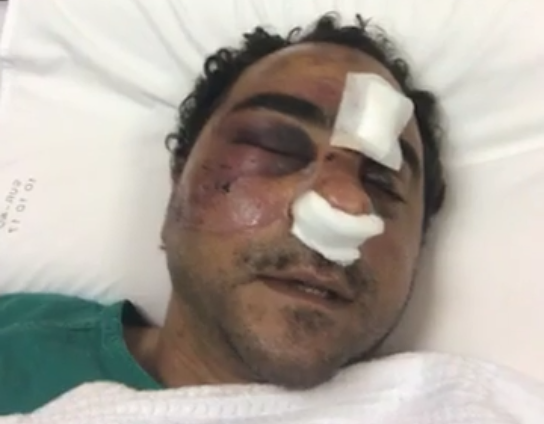 شاهد زيارة السفير المصرى بالكويت للمواطن المصرى الذى تم الإعتداء علية  (فيديو)
