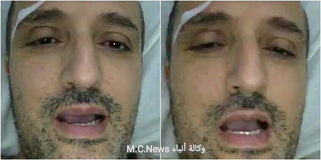 شريف مدكور لايف من فراش المرض للرد على الشائعات ومنها علاجة على نفقة الدولة  (فيديو)